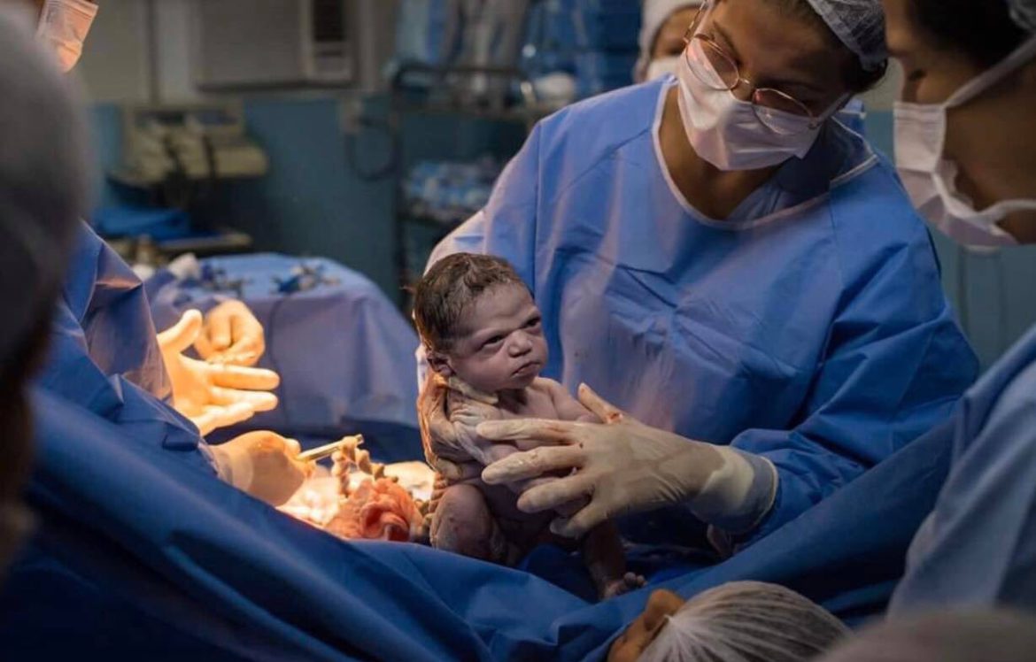 La increíble foto de la beba que nació «enojada» que causa furor en las redes