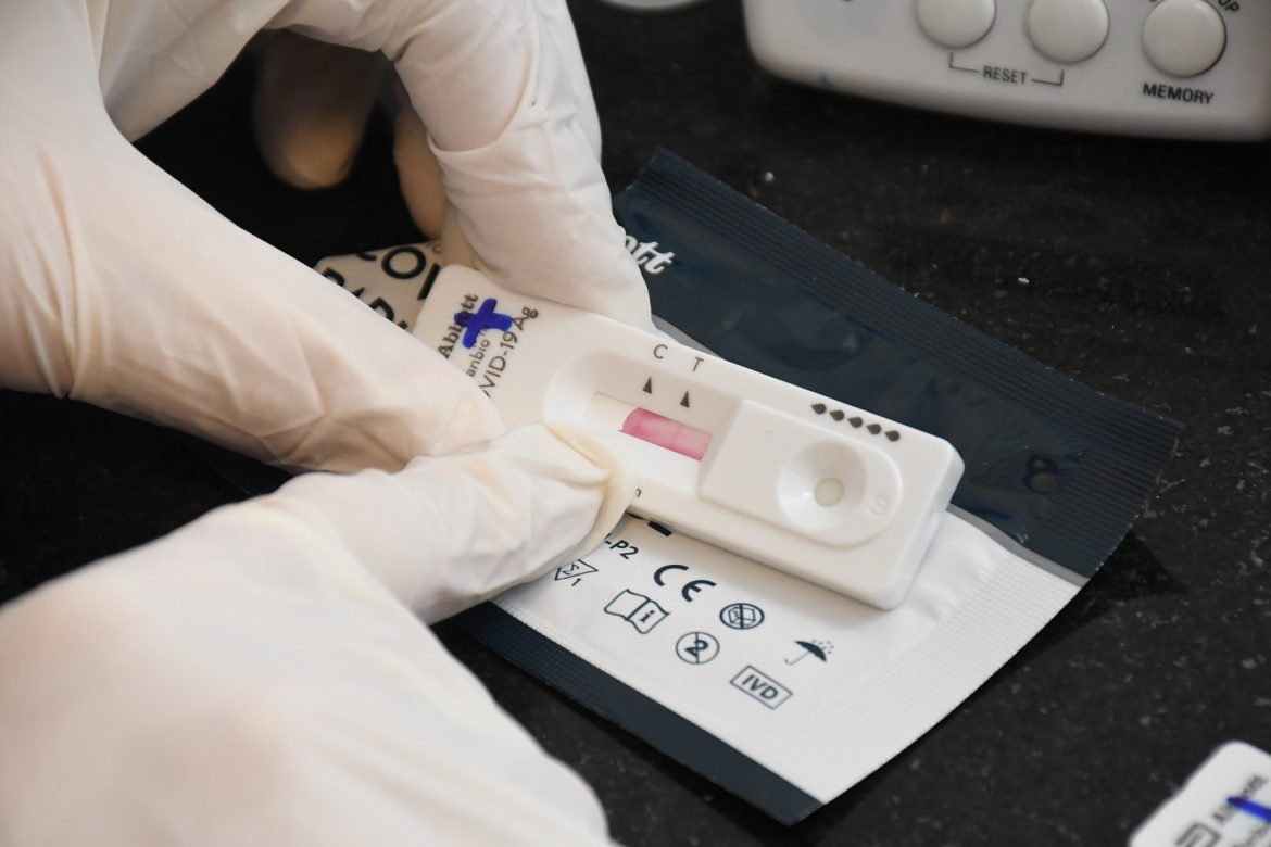 La Anmat autorizó el uso de autotest en Argentina: dónde se venderán