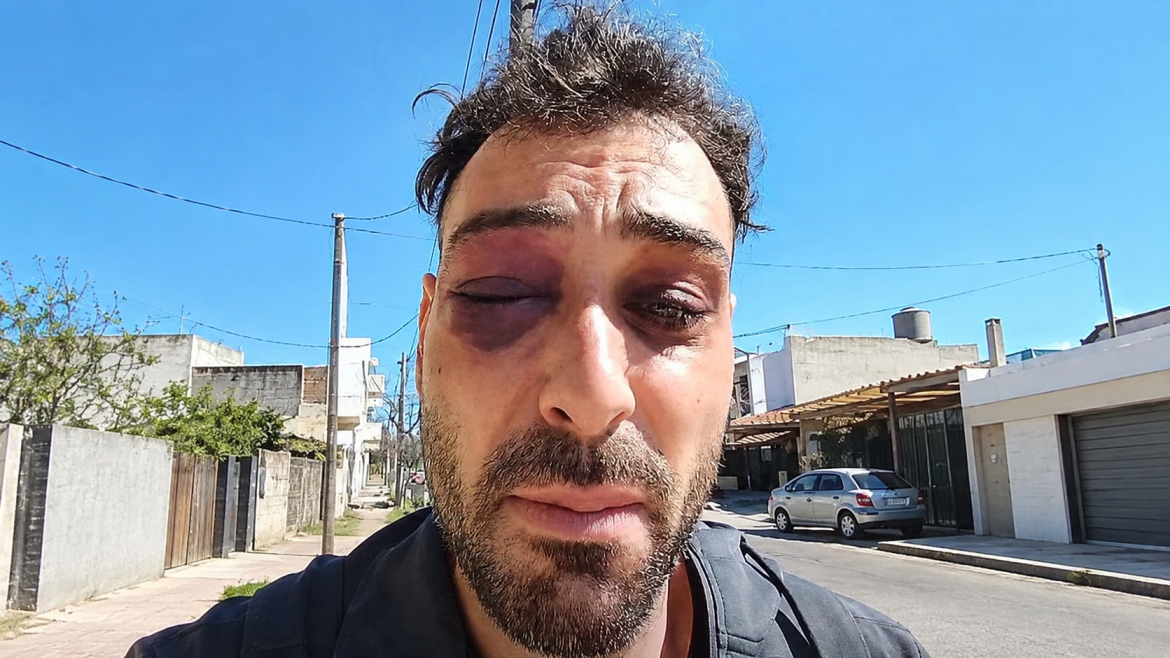 Golpiza a músico y luthier santarroseño: el 15 de octubre formalizan a 7 policías