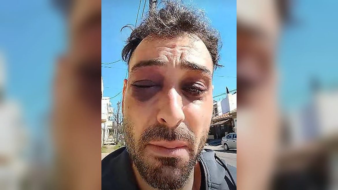 Denunció una golpiza policial luego de un incidente en la Terminal de Santa Rosa